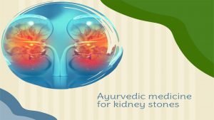Best Ayurvedic Medicine For Kidney Stones